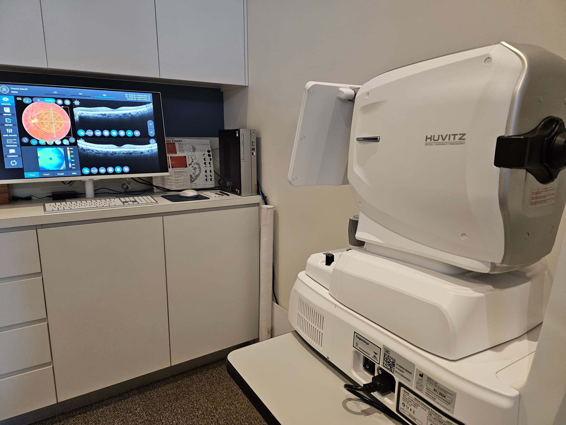 Gallery image 1: Atwell's OCT machine